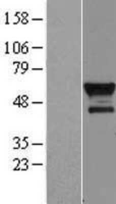 Western Blot: Bcl3 Overexpression Lysate [NBP2-07783]