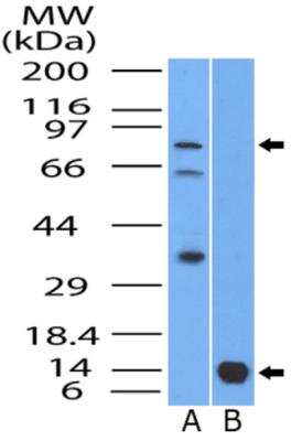 Western Blot: Bcl-6 Antibody [NBP2-31369]