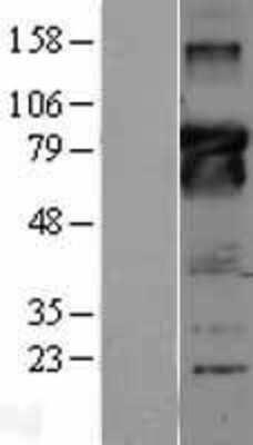 Western Blot: Bcl-6 Overexpression Lysate [NBL1-07951]