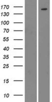 Western Blot: BCR Overexpression Lysate [NBP2-06527]