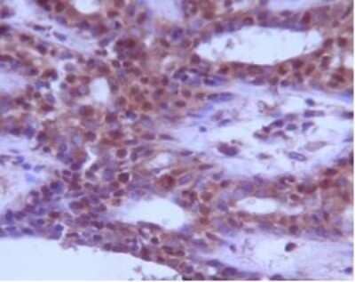 Immunohistochemistry: Beclin 1 Antibody - BSA Free [NB110-87318]