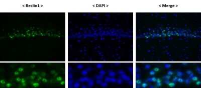 Immunohistochemistry-Frozen: Beclin 1 Antibody - BSA Free [NB500-249]