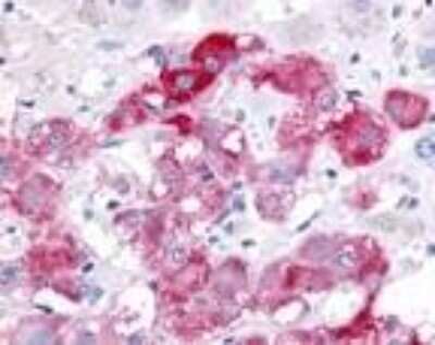 Immunohistochemistry: Beclin 1 Antibody - BSA Free [NB500-249]
