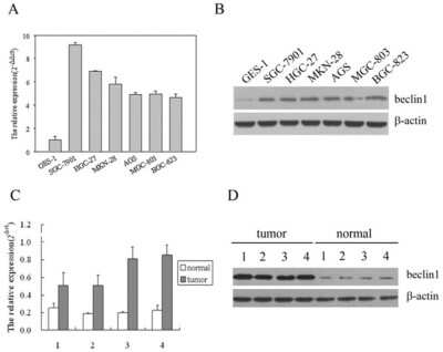 Western Blot: Beclin 1 AntibodyBSA Free [NB500-249]