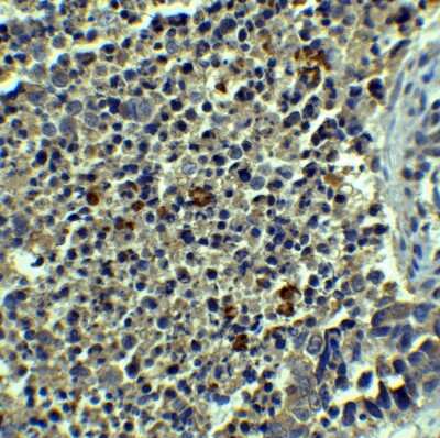 Immunohistochemistry: Beclin 1 Antibody - BSA Free [NBP1-76648]