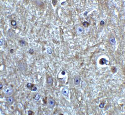 Immunohistochemistry: Beclin 1 Antibody - BSA Free [NBP1-76648]