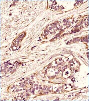 Immunohistochemistry-Paraffin: Beclin 1 Antibody - BSA Free [NB110-87318]