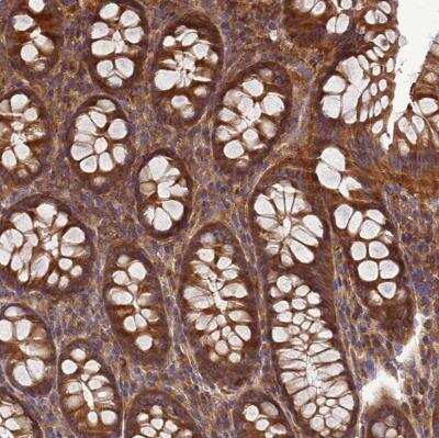 Immunohistochemistry-Paraffin: Beclin 1 Antibody [NBP2-38139]