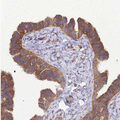 Immunohistochemistry-Paraffin: Beclin 1 Antibody [NBP2-38139]