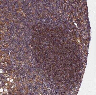 Immunohistochemistry-Paraffin: Beclin 1 Antibody [NBP2-38139]