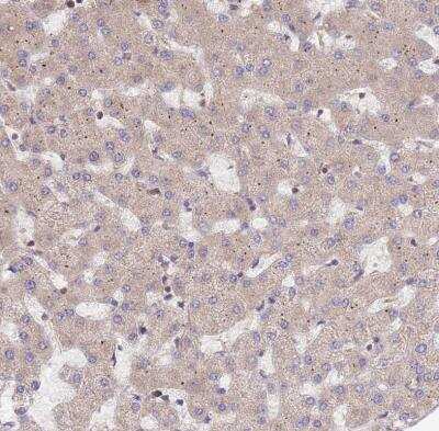Immunohistochemistry-Paraffin: Beclin 1 Antibody [NBP2-38139]