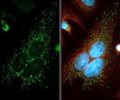 Immunocytochemistry/ Immunofluorescence: Beclin 1 Antibody Pack [NB910-95610]