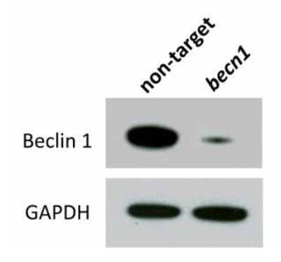 Knockdown Validated: Beclin 1 Antibody Pack [NB910-95610]