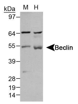 Western Blot: Beclin 1 Antibody Pack [NB910-95609]