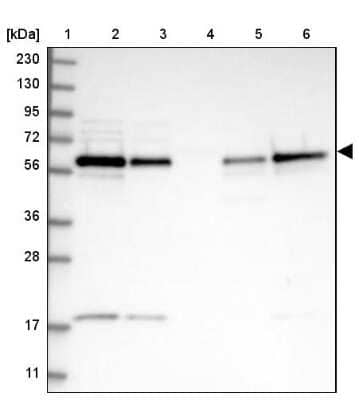 Western Blot: Beclin 1 Antibody [NBP2-38139]