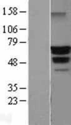 Western Blot: Beclin 1 Overexpression Lysate [NBL1-07966]