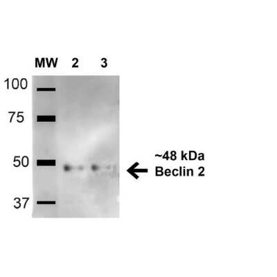 Western Blot: Beclin 2 Antibody [NBP3-18253]