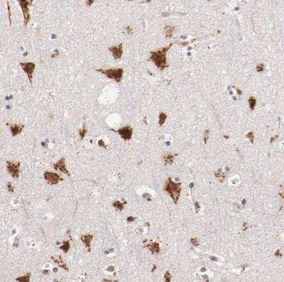 Immunohistochemistry-Paraffin: Begain Antibody [NBP1-82907]