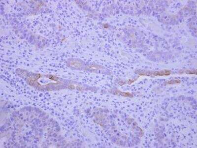 Immunohistochemistry-Paraffin: Begain Antibody [NBP2-15561]