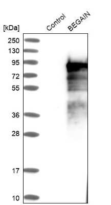 Western Blot: Begain Antibody [NBP1-82907]