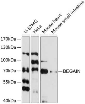 Western Blot: Begain AntibodyAzide and BSA Free [NBP2-92728]