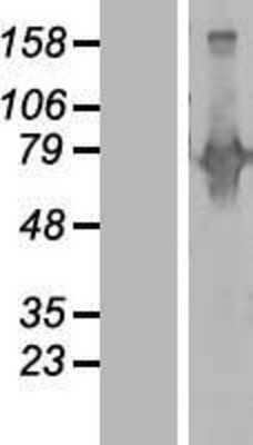 Western Blot: Begain Overexpression Lysate [NBL1-07967]