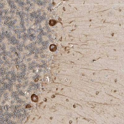 Immunohistochemistry: Bend6 Antibody [NBP1-88811]