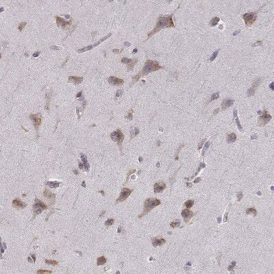 Immunohistochemistry-Paraffin: Bend6 Antibody [NBP1-88811]
