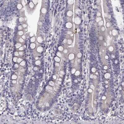 Immunohistochemistry-Paraffin: Bend6 Antibody [NBP1-88811]