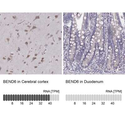 Immunohistochemistry-Paraffin: Bend6 Antibody [NBP1-88811]