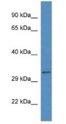 Western Blot: Bend6 Antibody [NBP1-74228]