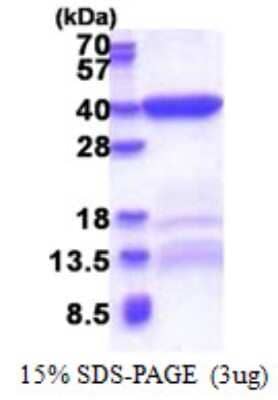 SDS-PAGE: Recombinant Human Bend6 His Protein [NBP2-22711]