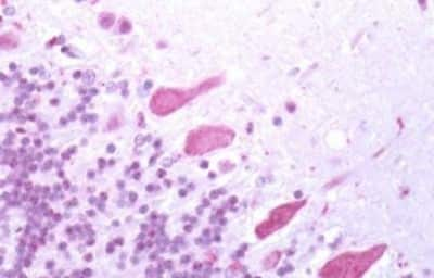 Immunohistochemistry-Paraffin: Bestrophin 3 Antibody [NBP3-14550]