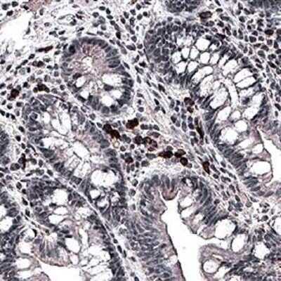 Immunohistochemistry-Paraffin: Bestrophin 1 Antibody (E6-6) - BSA Free [NB300-164]