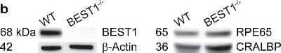 Knockout Validated: Bestrophin 1 Antibody (E6-6) - BSA Free [NB300-164]