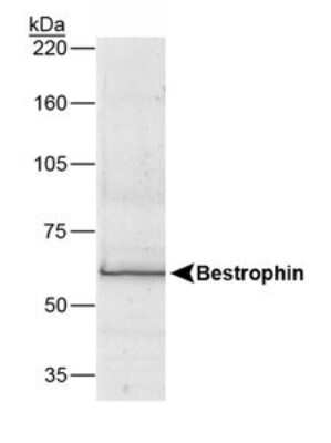 Western Blot: Bestrophin 1 Antibody (E6-6)BSA Free [NB300-164]