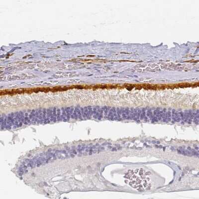 Immunohistochemistry-Paraffin: Bestrophin 1 Antibody [NBP2-56225]