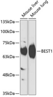 Western Blot: Bestrophin 1 AntibodyBSA Free [NBP2-92979]