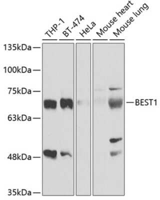 Western Blot: Bestrophin 1 AntibodyBSA Free [NBP2-92983]