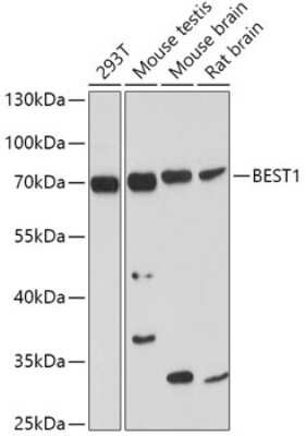 Western Blot: Bestrophin 1 AntibodyBSA Free [NBP2-92985]