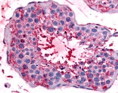 Immunohistochemistry-Paraffin: Bestrophin 2 Antibody - BSA Free [NB110-55620]