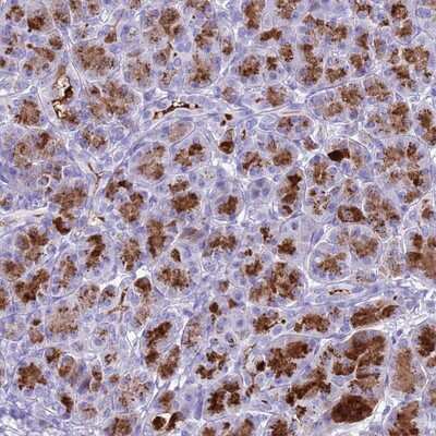 Immunohistochemistry-Paraffin: Bestrophin 2 Antibody [NBP1-91699]