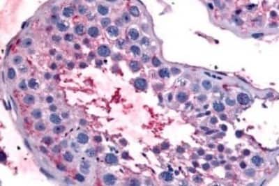 Immunohistochemistry-Paraffin: Bestrophin 2 Antibody [NBP3-14548]