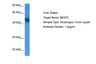 Western Blot: Bestrophin 2 Antibody [NBP2-84503]