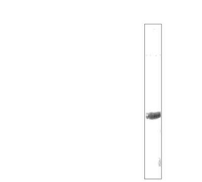 Western Blot: Bestrophin 2 Antibody [NBP3-12272]