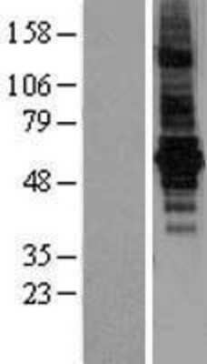 Western Blot: Bestrophin 2 Overexpression Lysate [NBL1-07968]