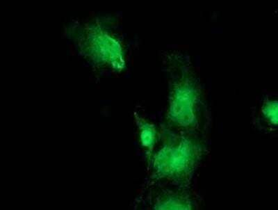 Immunocytochemistry/ Immunofluorescence: Bestrophin 3 Antibody (OTI2H3) [NBP2-03253]