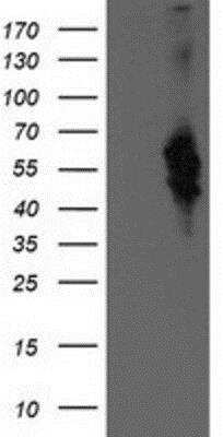 Western Blot: Bestrophin 3 Antibody (OTI2H3) [NBP2-03253]