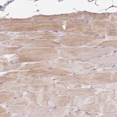 Immunohistochemistry-Paraffin: Bestrophin 3 Antibody [NBP2-49138]