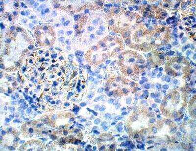 Immunohistochemistry-Paraffin: Bestrophin 3 Antibody [NBP3-12276]